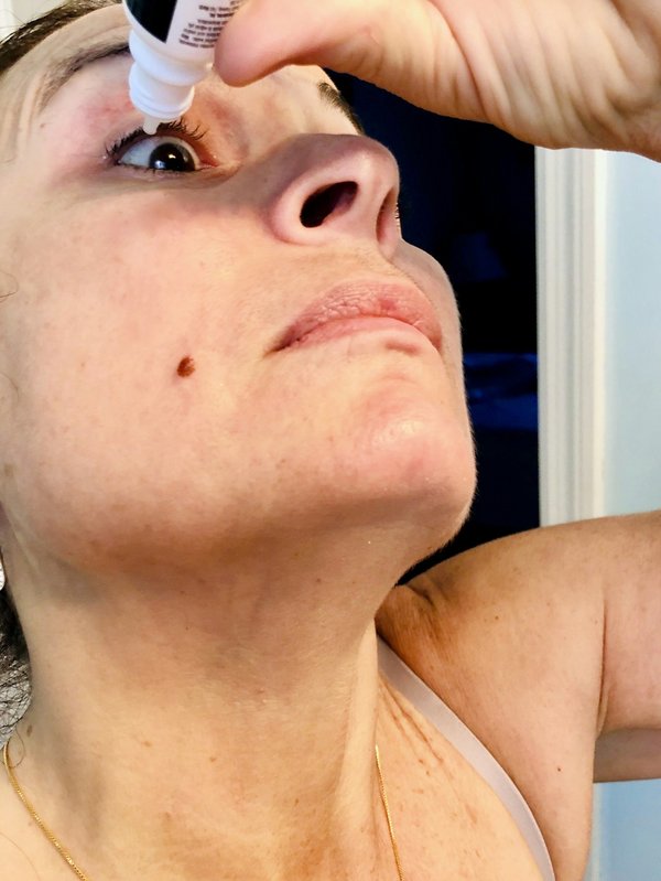 Comprendre la sécheresse oculaire sévère : causes et solutions